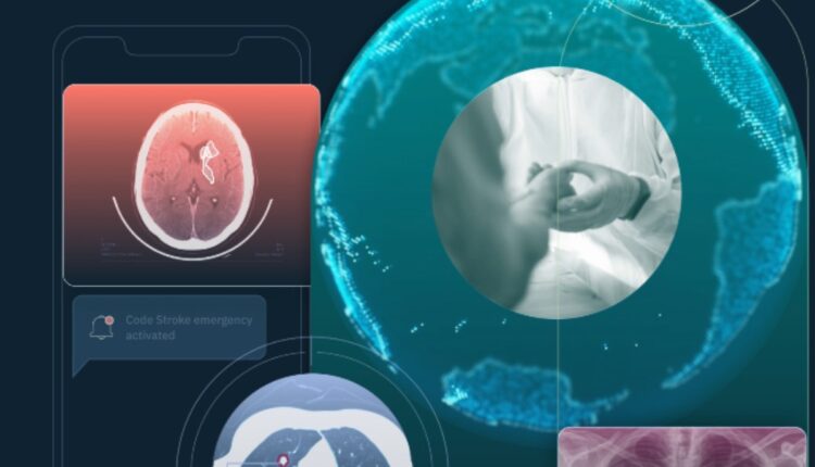 Qure.AI, an Indian healthcare AI startup, aims for profitability and IPO within two years, expanding globally with innovative medical solutions.