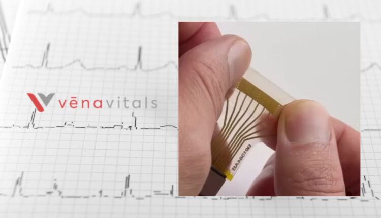 continuous blood pressure monitoring